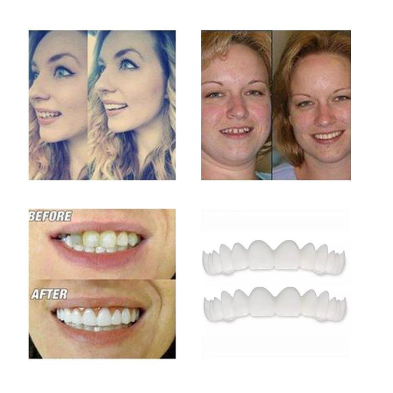 Magic Smile Teeth Brace